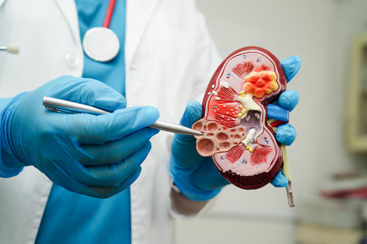 Chronic Kidney Disease Management